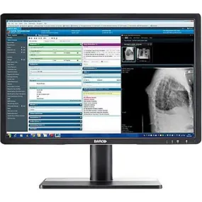 NOB BARCO EONIS MDRC-2224 K9301808A 24-inch IPS LED Monitor - 1080p - 1000:1 - 14 ms - Black